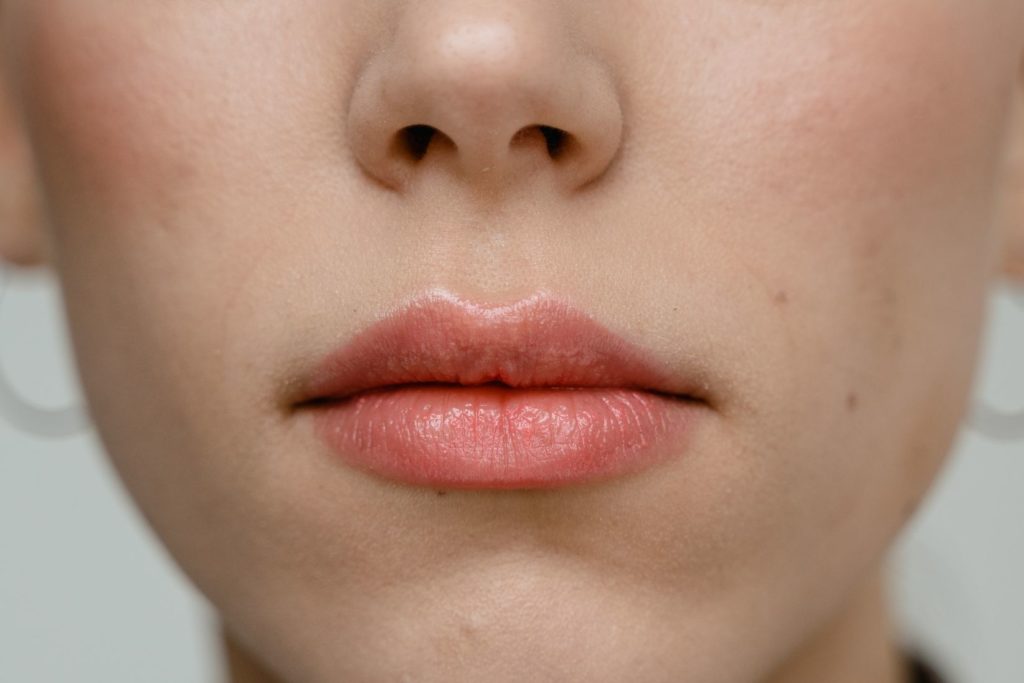 botox i læberne
læbeløft
liplift
lip lift 
